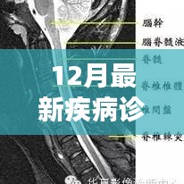 最新疾病诊断系统全面评测与介绍，深入了解十二月最新疾病诊断系统