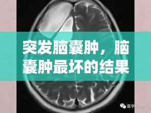 突发脑囊肿，脑囊肿最坏的结果 