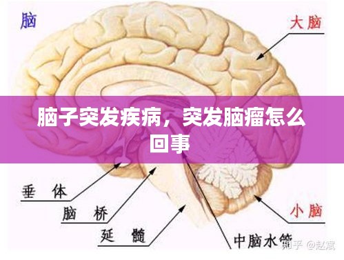 脑子突发疾病，突发脑瘤怎么回事 