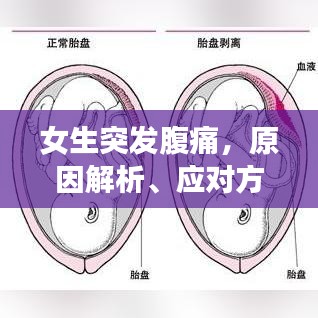 女生突发腹痛，原因解析、应对方法与预防策略全解析